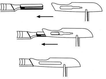 Het bevestigen van een Swann Morton scalpelmesje